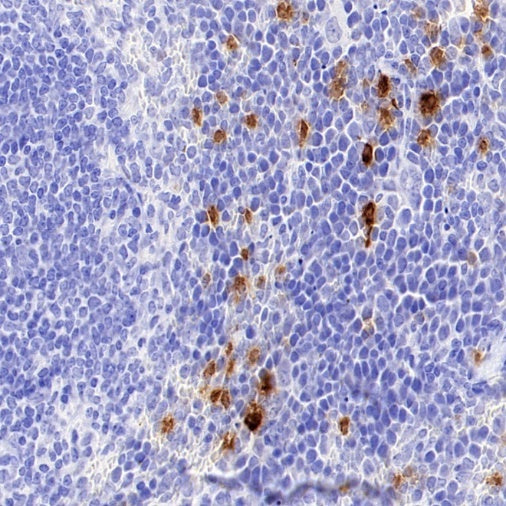 Neutrophil Elastase (ELA2) Recombinant Rabbit mAb (S-3766-3)