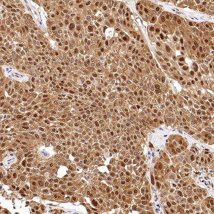 ACLY/ATP citrate lyase Recombinant Rabbit mAb (S-2025-32)