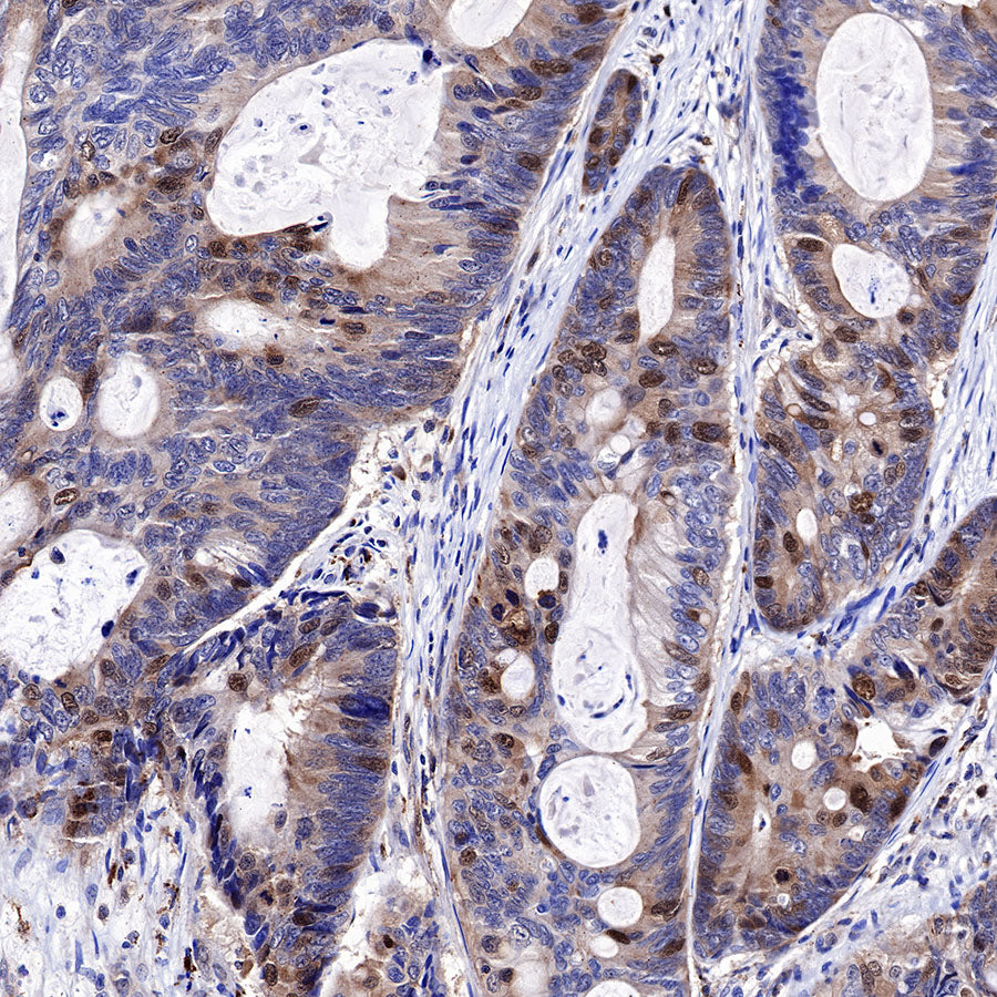 CDK2 Recombinant Rabbit mAb (SDT-064-40)