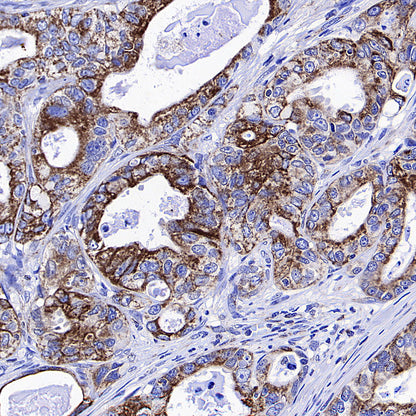 WWP1 Recombinant Rabbit mAb (S-4412-25)
