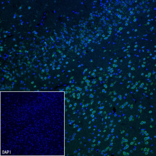 NeuroD2 Recombinant Rabbit mAb (S-3092-64)