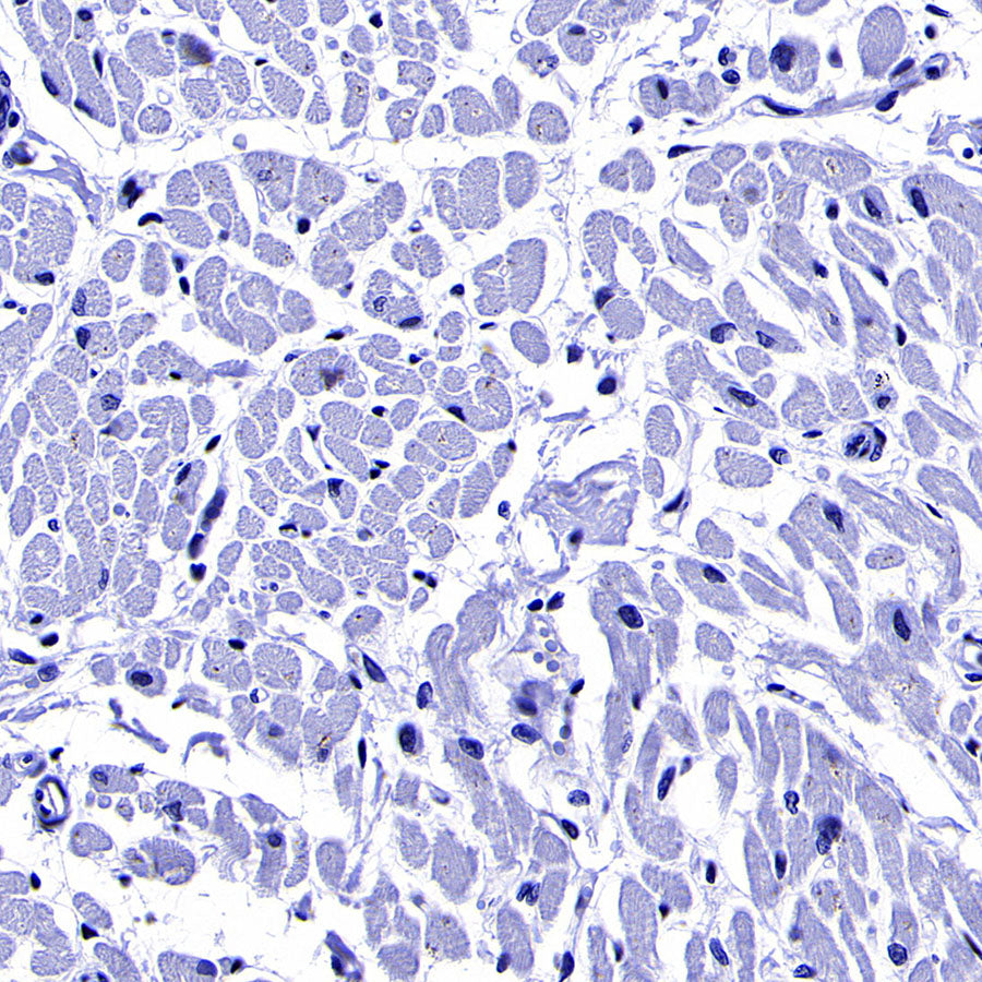 ITPR1 Recombinant Rabbit mAb (S-4530-47)