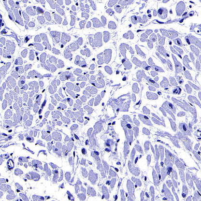 ITPR1 Recombinant Rabbit mAb (S-4530-47)