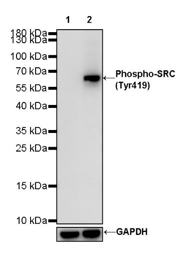 Phospho-SRC (Tyr419) Recombinant Rabbit mAb (S-1182-5)