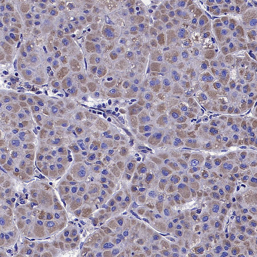 ALDH2 Rabbit Polyclonal Antibody
