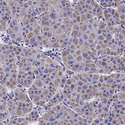 ALDH2 Rabbit Polyclonal Antibody