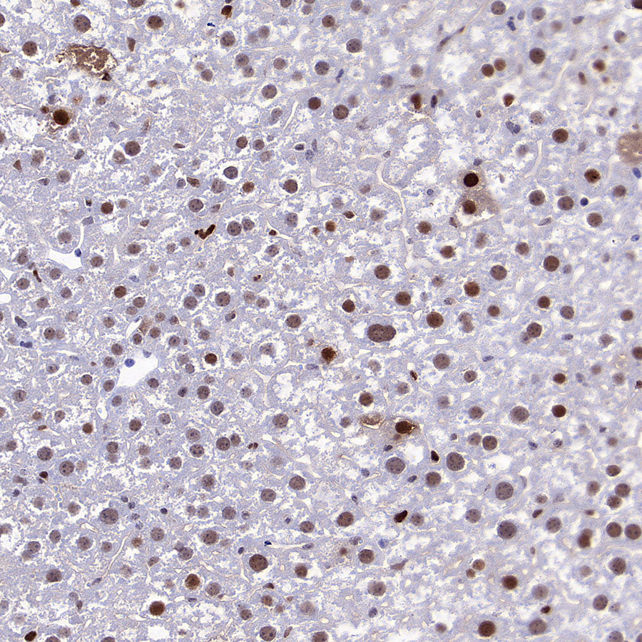 PCNA Recombinant Mouse mAb (S-5477)