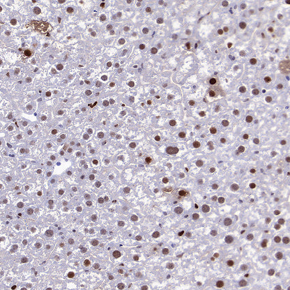 PCNA Recombinant Mouse mAb (S-5477)