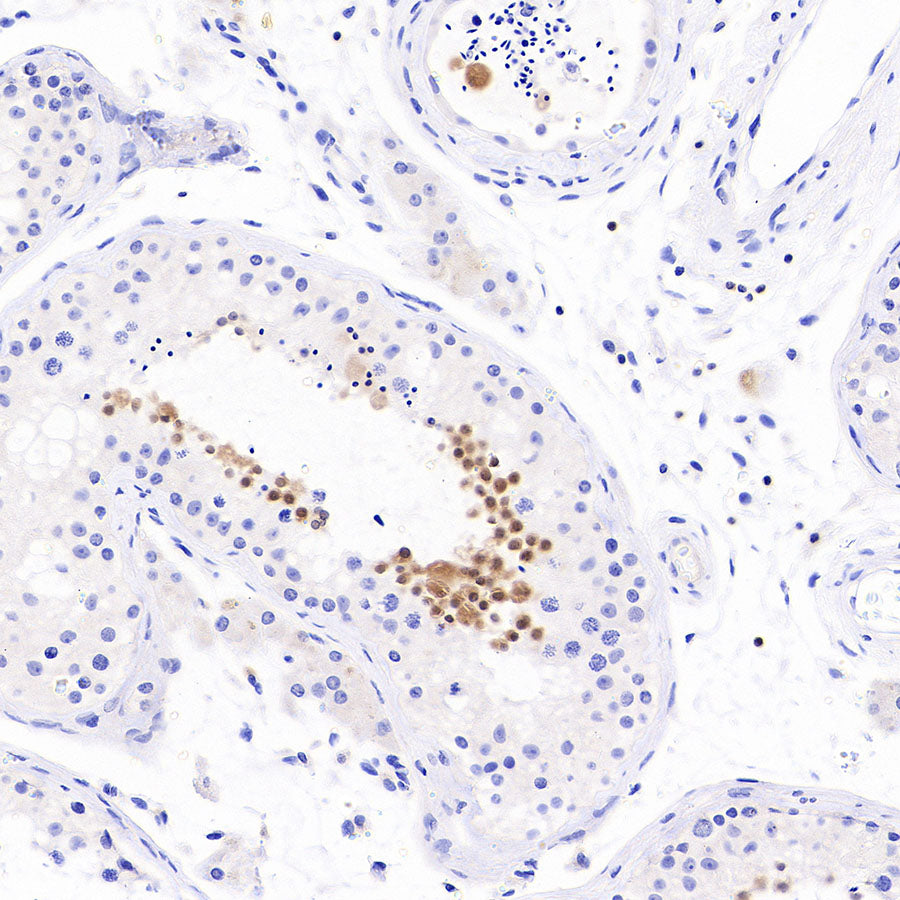 Stat4 Recombinant Rabbit mAb (S-4916-70)