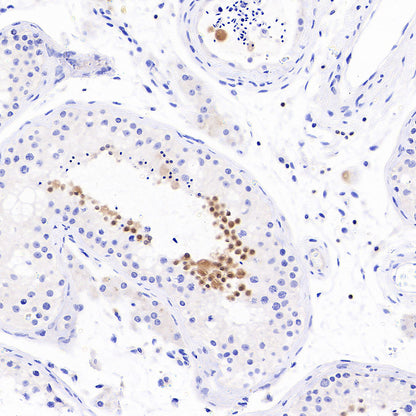 Stat4 Recombinant Rabbit mAb (S-4916-70)