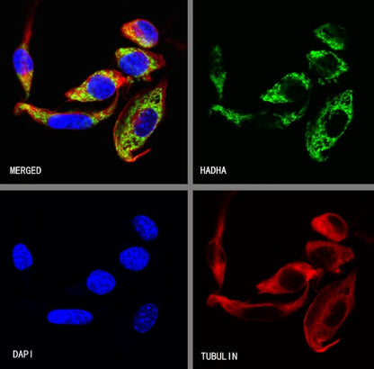 HADHA Recombinant Rabbit mAb (S-2345-8)
