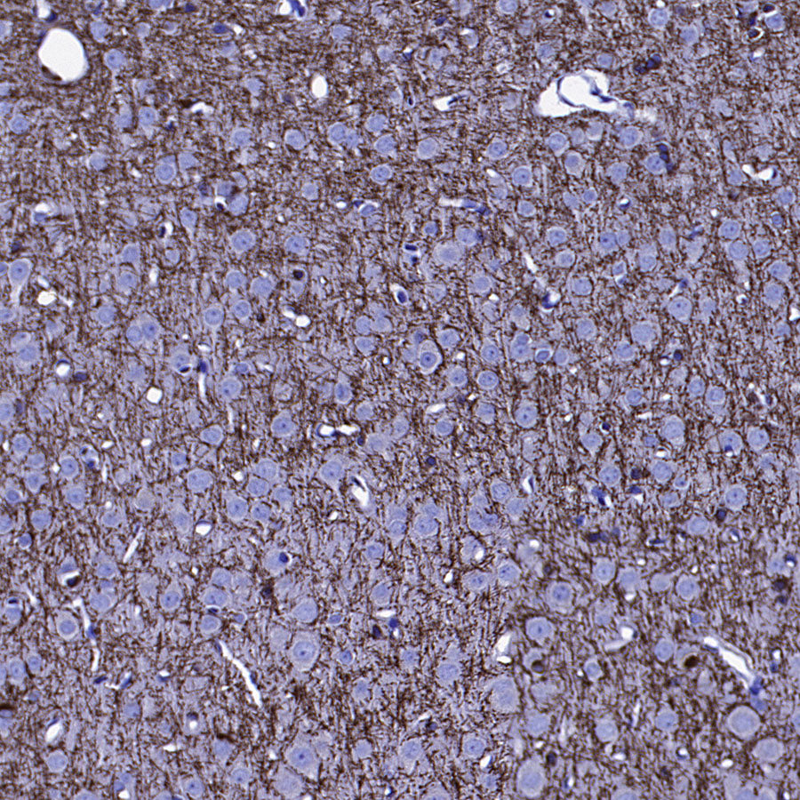 SIRT2 Mouse mAb