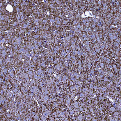SIRT2 Mouse mAb
