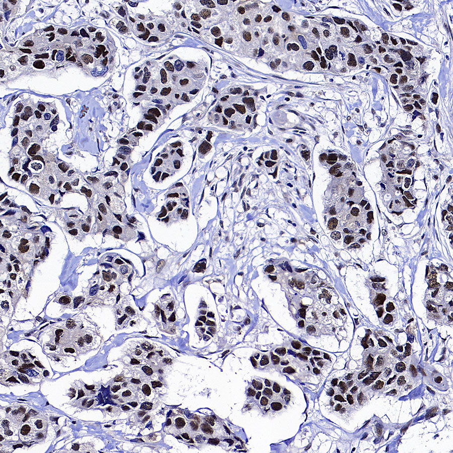 NSUN2 Mouse mAb