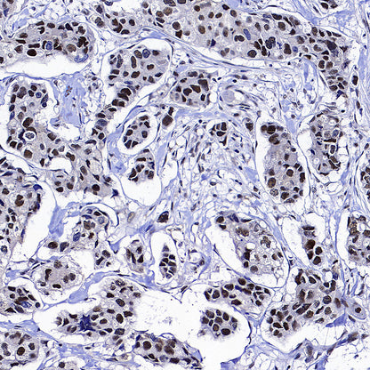 NSUN2 Mouse mAb