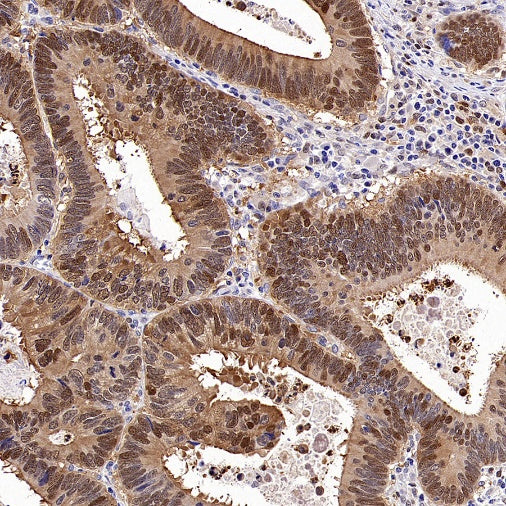 PBEF/Visfatin/NAMPT Rabbit Polyclonal Antibody
