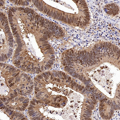 PBEF/Visfatin/NAMPT Rabbit Polyclonal Antibody