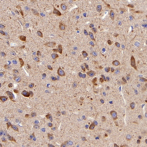 KIF3A Recombinant Rabbit mAb (S-1083-9)
