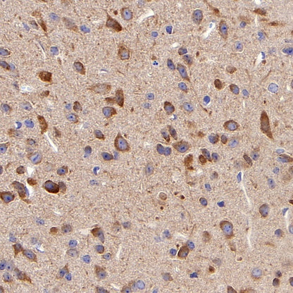 KIF3A Recombinant Rabbit mAb (S-1083-9)