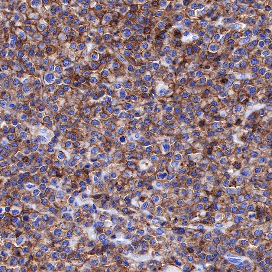 S-RMab® CD45 Recombinant Rabbit mAb,PBS Only (SDT-R035)