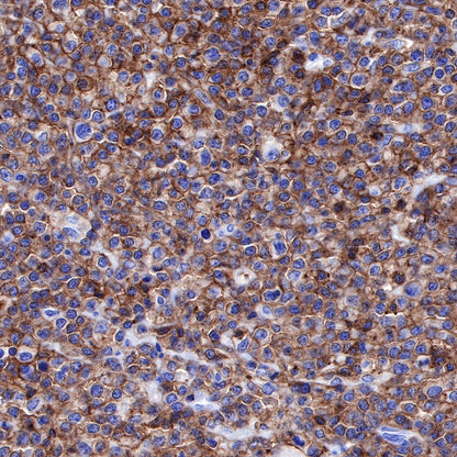 S-RMab® CD45 Recombinant Rabbit mAb,PBS Only (SDT-R035)