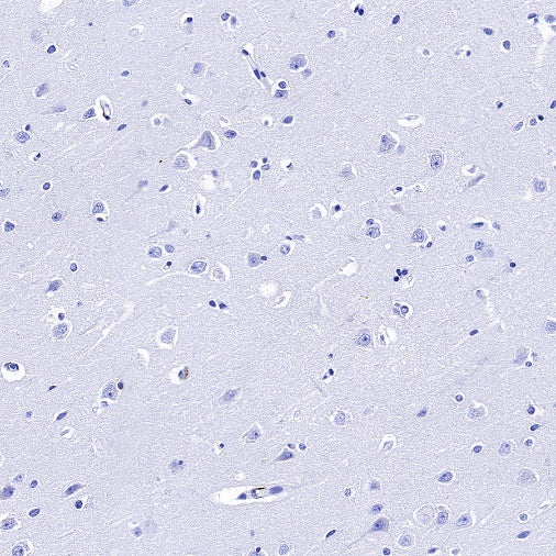 CD14 Mouse mAb (SDT-631-7)