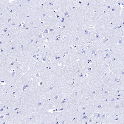 CD14 Mouse mAb (SDT-631-7)