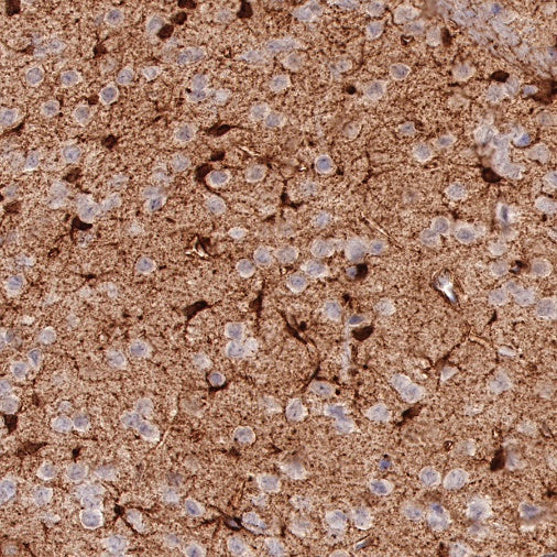 NDRG2 Recombinant Rabbit mAb (S-618-76)