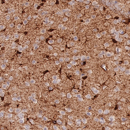 NDRG2 Recombinant Rabbit mAb (S-618-76)