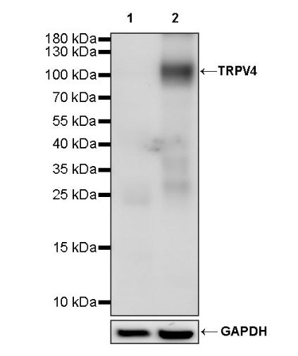TRPV4 Recombinant Rabbit mAb (S-1746-65)