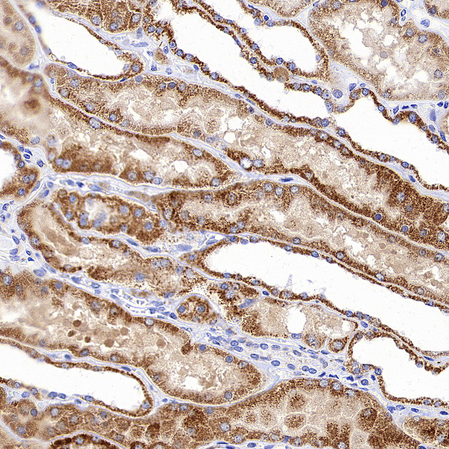 Aass Recombinant Rabbit mAb (S-4170-22)