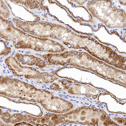Aass Recombinant Rabbit mAb (S-4170-22)