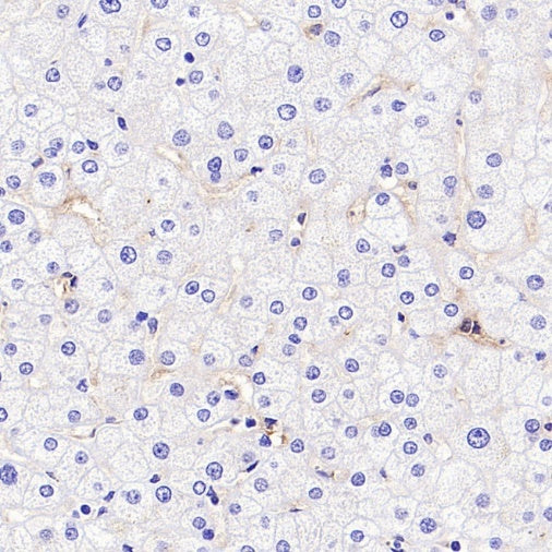 LYVE1 Recombinant Rabbit mAb (S-3786-26)