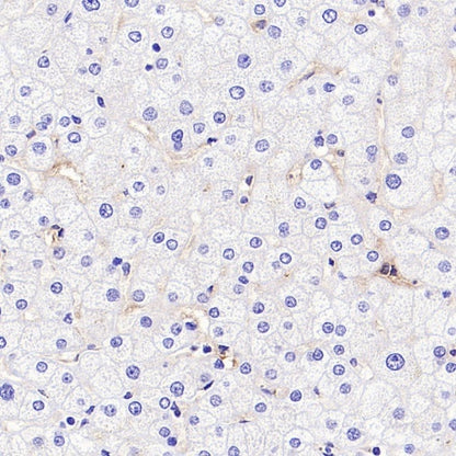 LYVE1 Recombinant Rabbit mAb (S-3786-26)