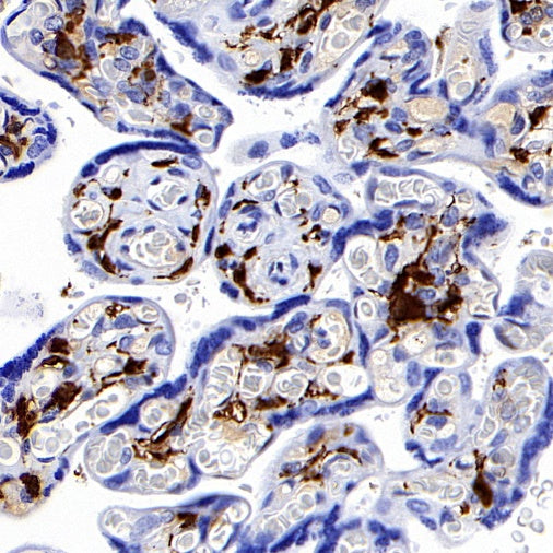 S-RMab® Factor XIIIa Recombinant Rabbit mAb (SDT-R278)