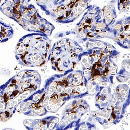 S-RMab® Factor XIIIa Recombinant Rabbit mAb (SDT-R278)
