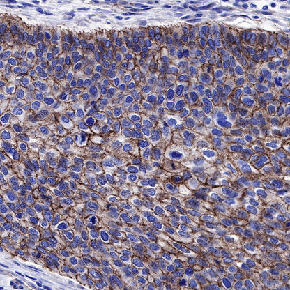 β-Catenin Recombinant Rabbit mAb,PBS Only (SDT-336-23)