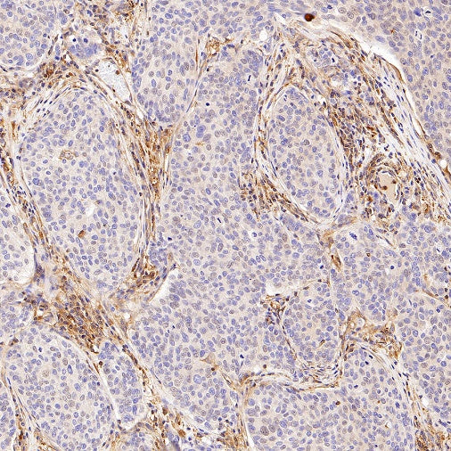 Talin-1 Recombinant Rabbit mAb (S-1483-25)