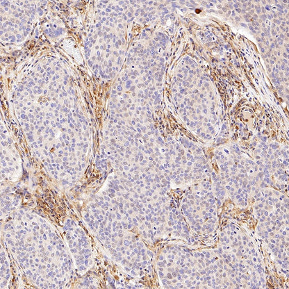 Talin-1 Recombinant Rabbit mAb (S-1483-25)