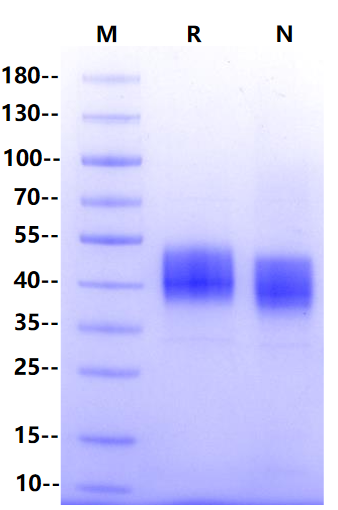 Biotinylated IL-21 R His&Avi Tag Protein, Human