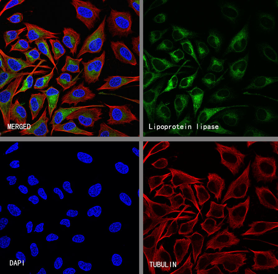 Lipoprotein lipase Recombinant Mouse mAb (S-5402)