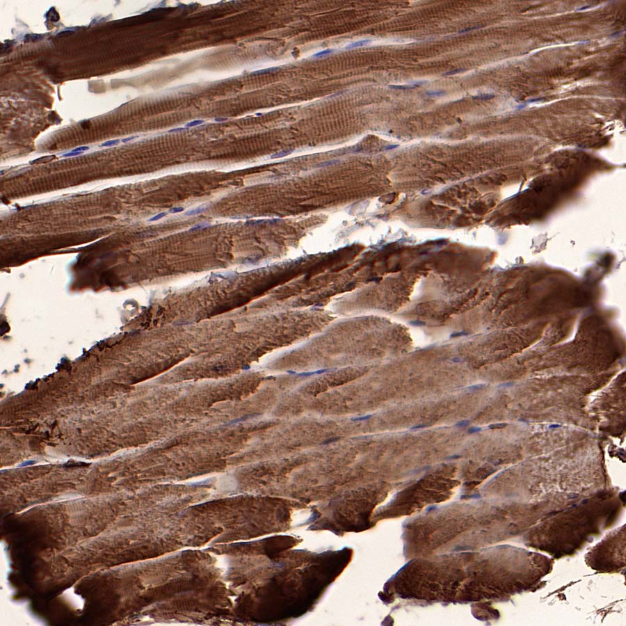 Aldolase A Recombinant Rabbit mAb (S-4007-23)