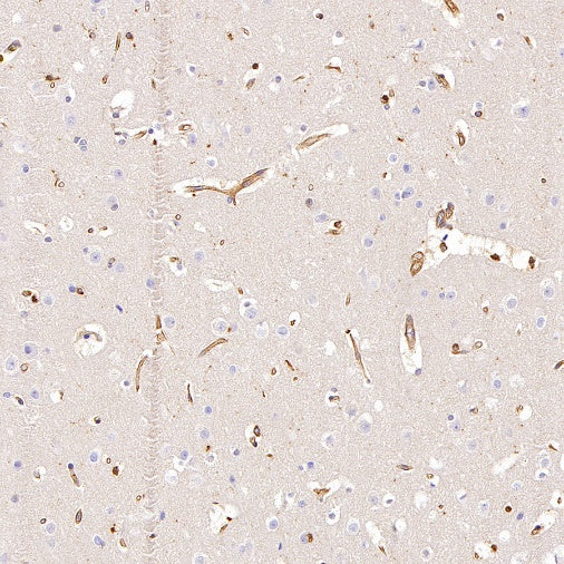 Talin-1 Recombinant Rabbit mAb (S-1483-25)
