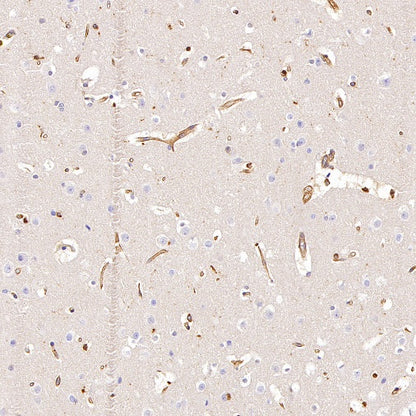 Talin-1 Recombinant Rabbit mAb (S-1483-25)