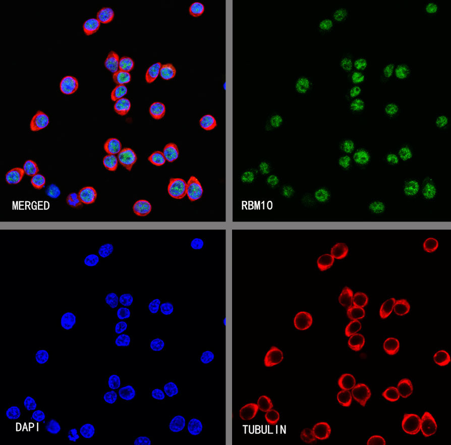 RBM10 Recombinant Rabbit mAb (S-4370-47)