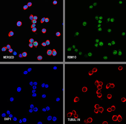 RBM10 Recombinant Rabbit mAb (S-4370-47)