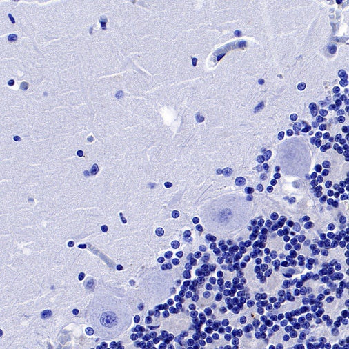 PPARγ Recombinant Rabbit mAb (SDT-556-108)