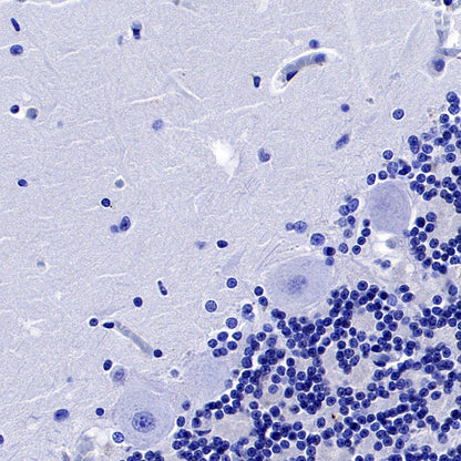 PPARγ Recombinant Rabbit mAb (SDT-556-108)