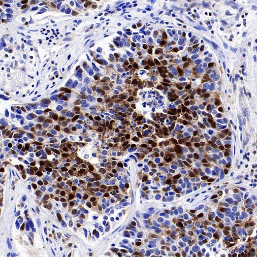 p27 Kip1 Recombinant Rabbit mAb (SDT-361-324)