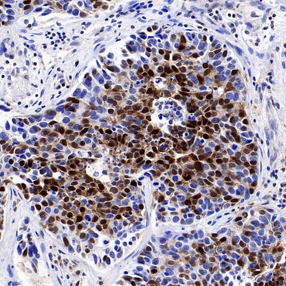 p27 Kip1 Recombinant Rabbit mAb (SDT-361-324)